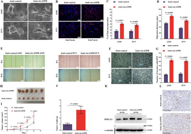 HMGA2 Antibody in Immunohistochemistry (IHC)