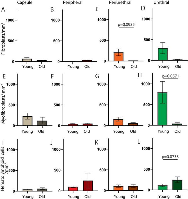 Alpha-Smooth Muscle Actin Antibody in Immunohistochemistry (IHC)