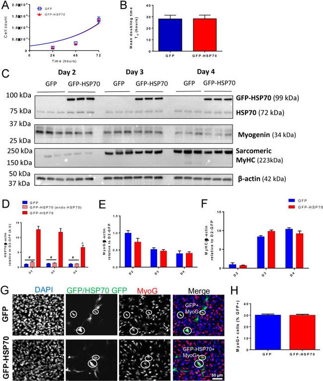 Myogenin Antibody in Immunocytochemistry (ICC/IF)