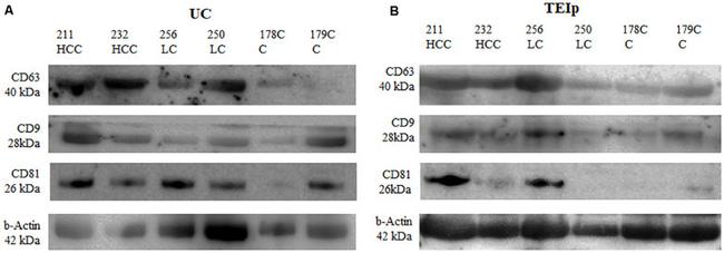 CD63 Antibody in Western Blot (WB)