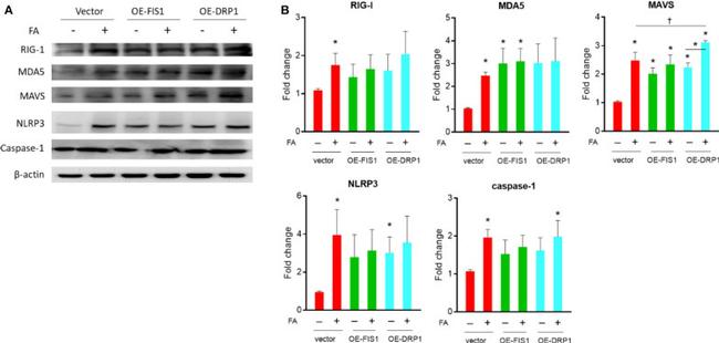 RIG-I Antibody in Western Blot (WB)