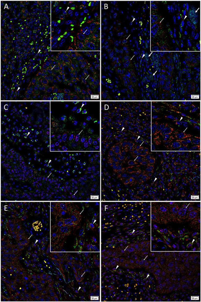 SOX2 Antibody in Immunohistochemistry (IHC)