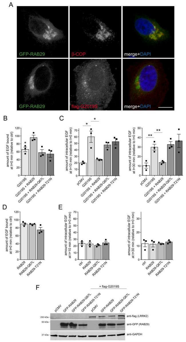 beta COP Antibody in Immunocytochemistry (ICC/IF)