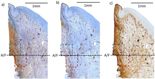 CD20 Antibody in Immunohistochemistry (IHC)