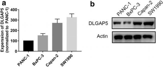 DLG7 Antibody in Western Blot (WB)