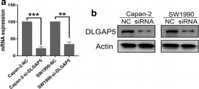 DLG7 Antibody in Western Blot (WB)