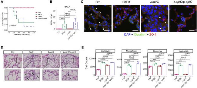 Claudin 1 Antibody in Immunohistochemistry (IHC)