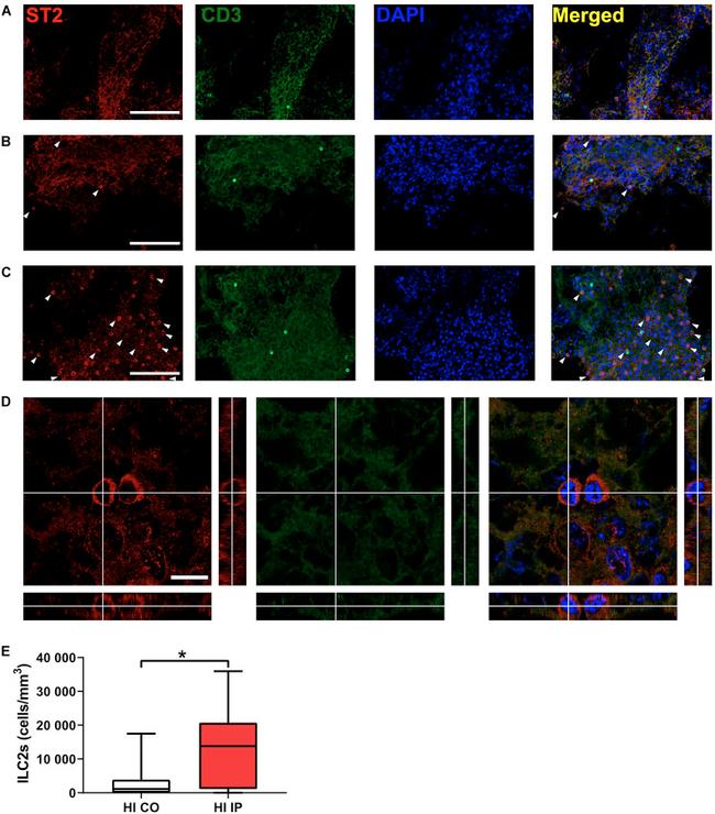 ST2 Antibody in Immunohistochemistry (IHC)