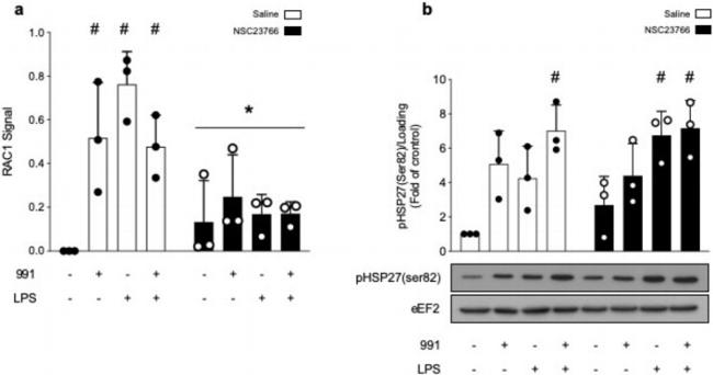 EEF2 Antibody in Western Blot (WB)