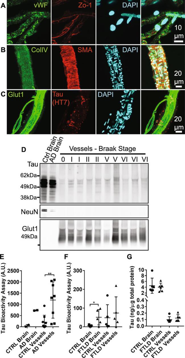 Tau Antibody in Western Blot (WB)