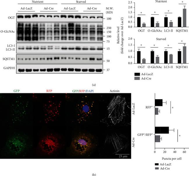 O-linked N-acetylglucosamine (O-GlcNAc) Antibody in Western Blot (WB)