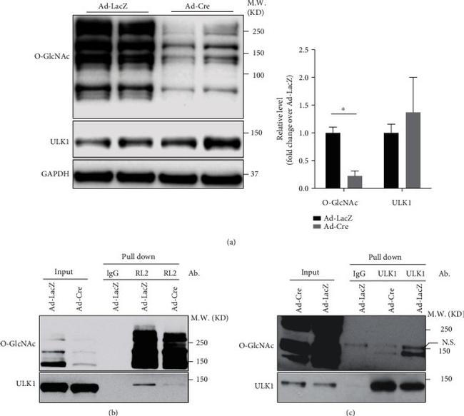 O-linked N-acetylglucosamine (O-GlcNAc) Antibody in Western Blot, Immunoprecipitation (WB, IP)