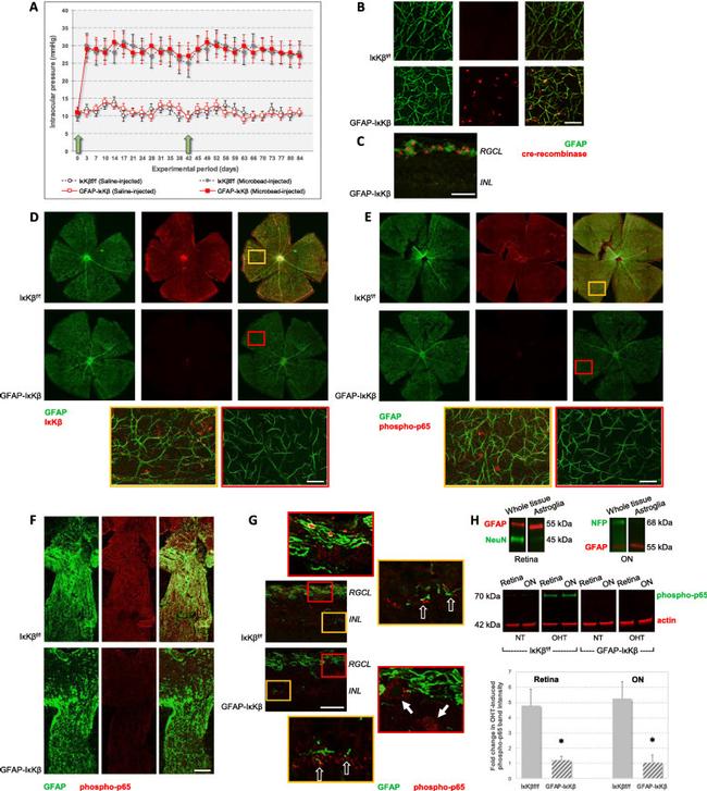 IKK beta Antibody in Immunohistochemistry (IHC)