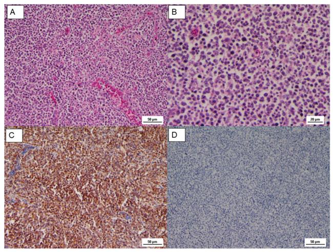 CD20 Antibody in Immunohistochemistry (IHC)