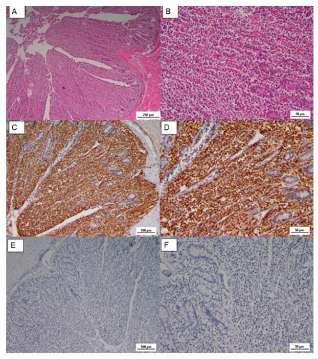 CD20 Antibody in Immunohistochemistry (IHC)