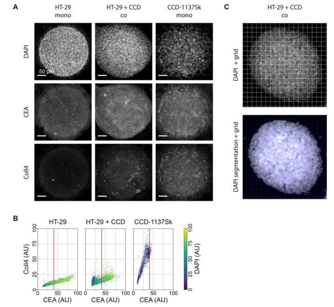 CEA Antibody in Immunocytochemistry (ICC/IF)