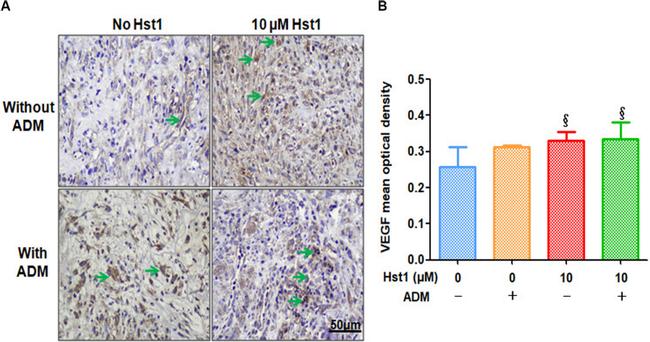 VEGF Antibody in Immunohistochemistry (IHC)