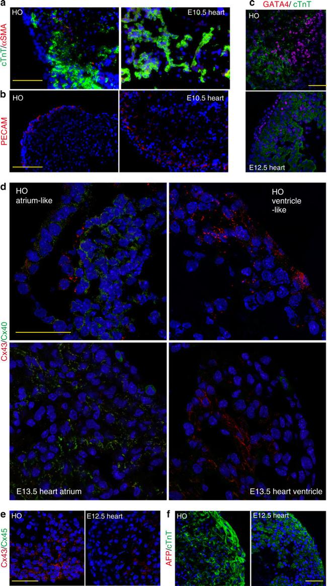 Connexin 40 Antibody in Immunohistochemistry (IHC)