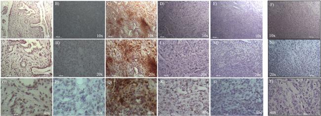 SOX2 Antibody in Immunohistochemistry (IHC)