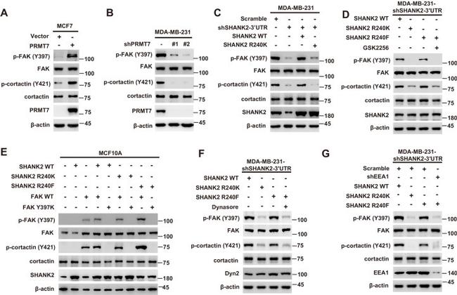 Phospho-FAK (Tyr397) Antibody in Western Blot (WB)