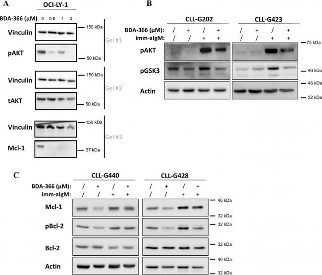 Bcl-2 Antibody in Western Blot (WB)