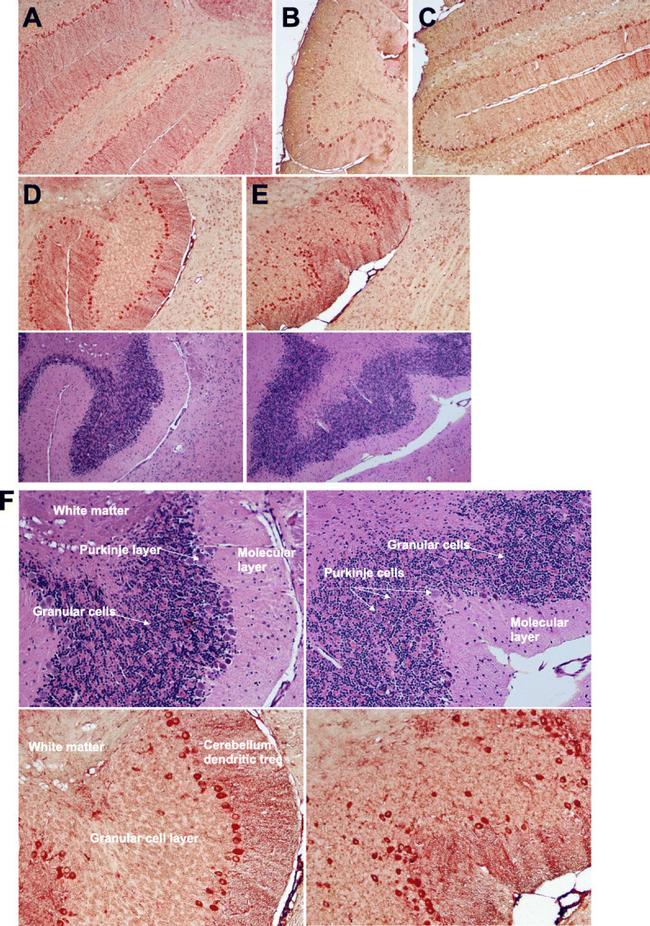 IBA1 Antibody in Immunohistochemistry (IHC)