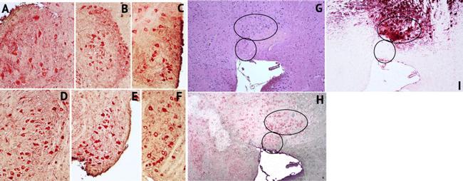 IBA1 Antibody in Immunohistochemistry (Paraffin) (IHC (P))