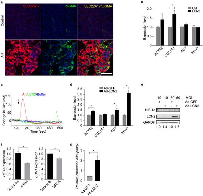 HIF1A Antibody in ChIP Assay (ChIP)