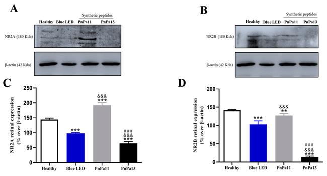 NMDAR2A Antibody in Western Blot (WB)