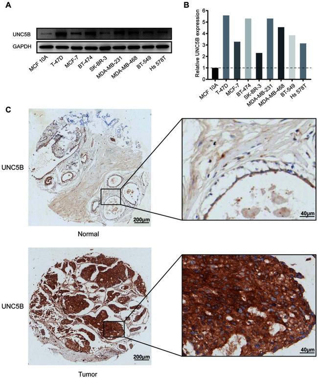 UNC5B Antibody in Immunohistochemistry (IHC)