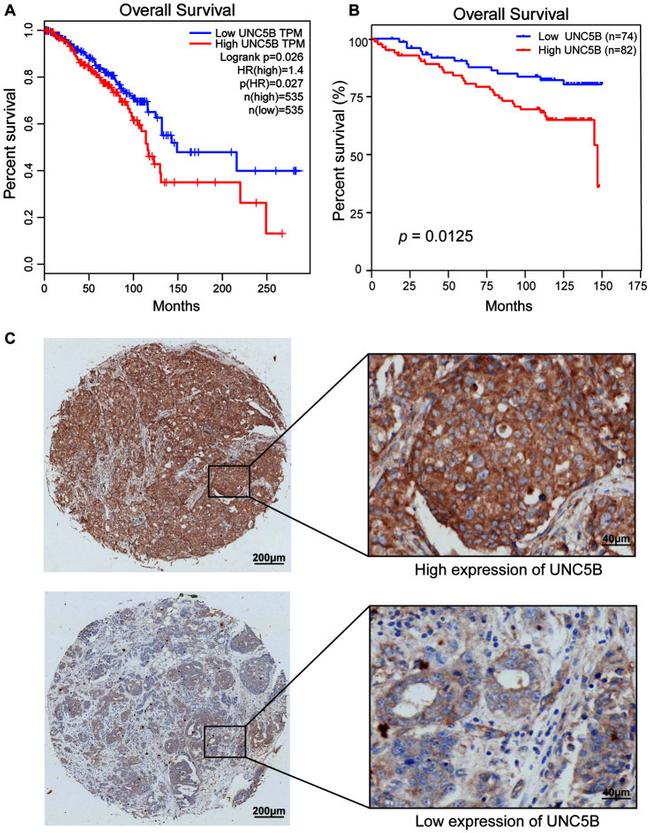 UNC5B Antibody in Immunohistochemistry (IHC)