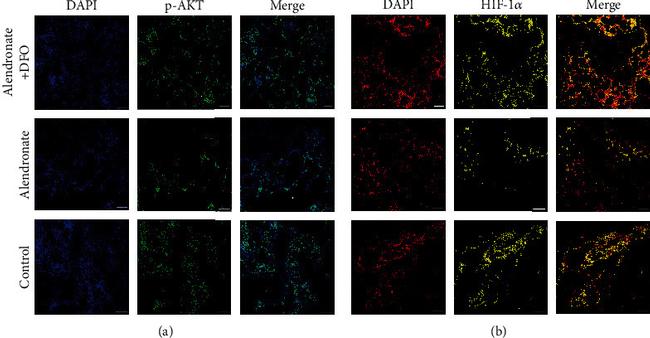 NFATC1 Antibody in Immunocytochemistry (ICC/IF)