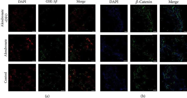 NFATC1 Antibody in Immunocytochemistry (ICC/IF)