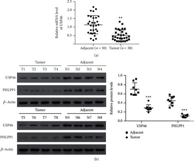 PHLPP1 Antibody in Western Blot (WB)