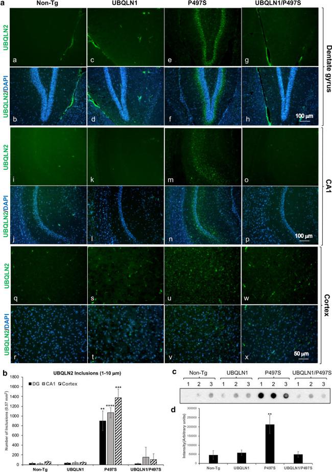 Ubiquilin 2 Antibody in Immunohistochemistry (IHC)