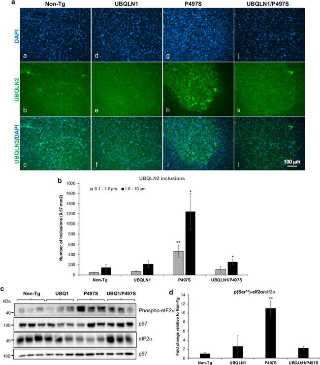 Ubiquilin 2 Antibody in Immunohistochemistry (IHC)