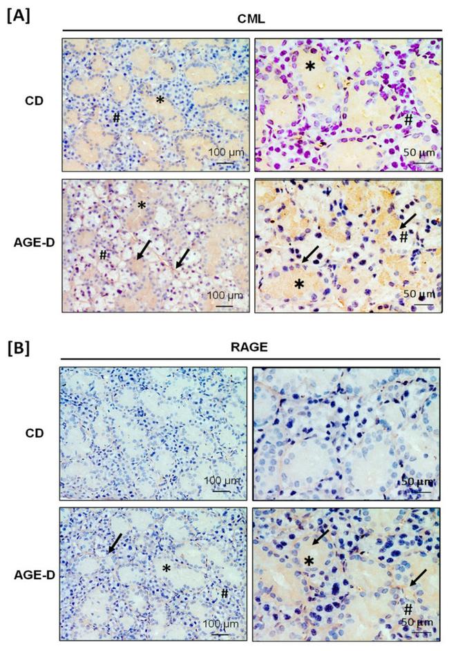 RAGE Antibody in Immunohistochemistry (IHC)