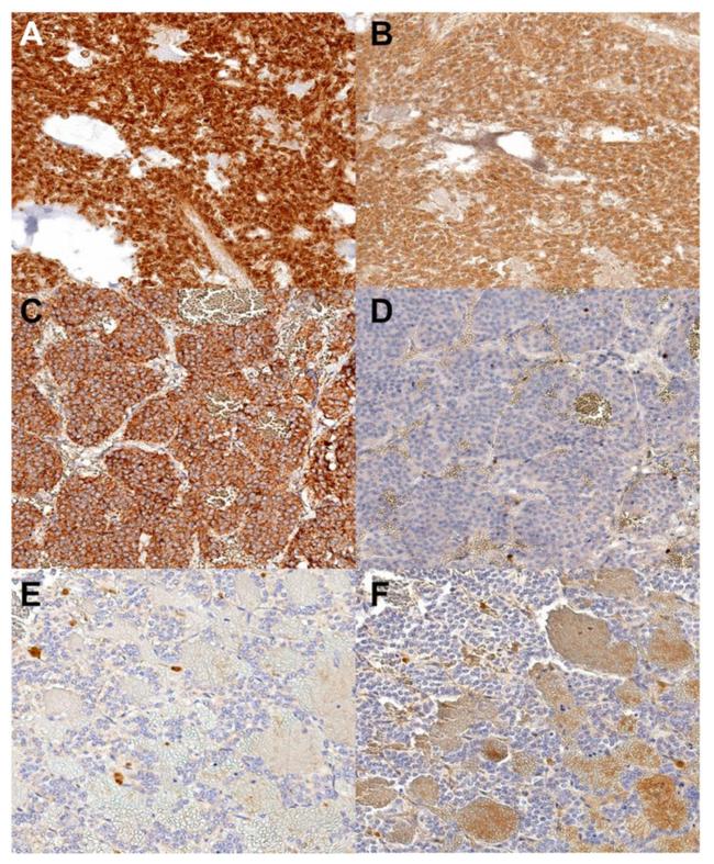 SDHB Antibody in Immunohistochemistry (IHC)