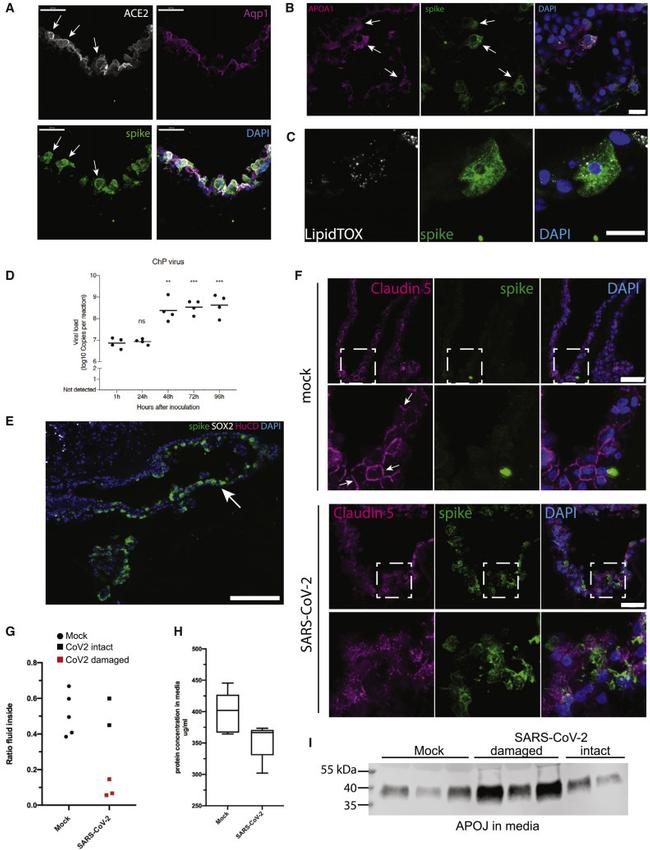 ApoA1 Antibody in Immunocytochemistry (ICC/IF)