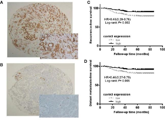 PRKCDBP Antibody in Immunohistochemistry (IHC)