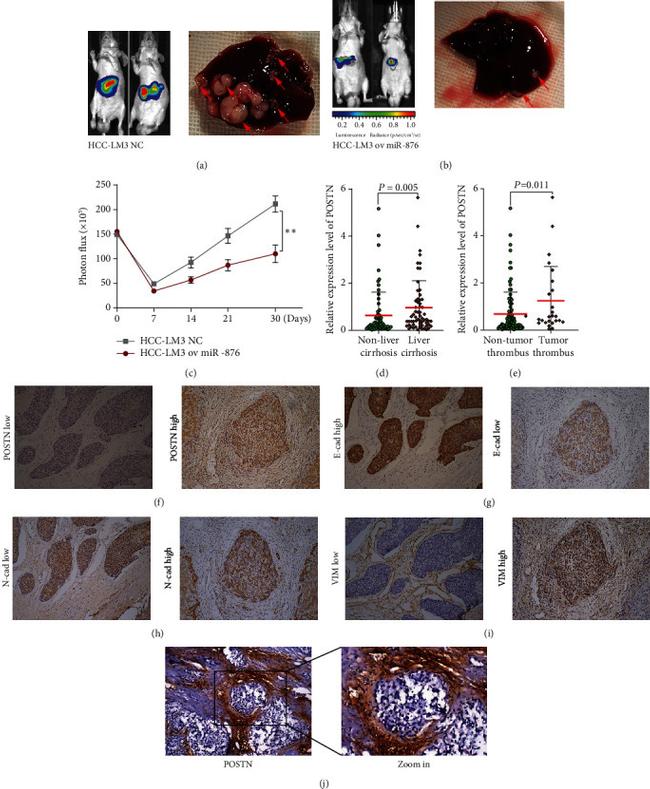 Periostin Antibody in Immunohistochemistry (IHC)