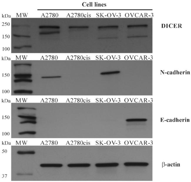 Actin Antibody in Western Blot (WB)