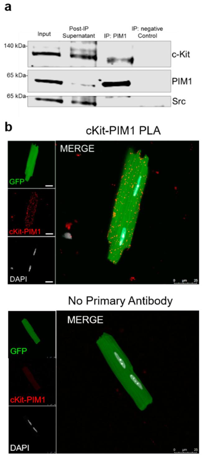 PIM1 Antibody in Immunocytochemistry, Proximity Ligation Assay (PLA) (ICC/IF, PLA)