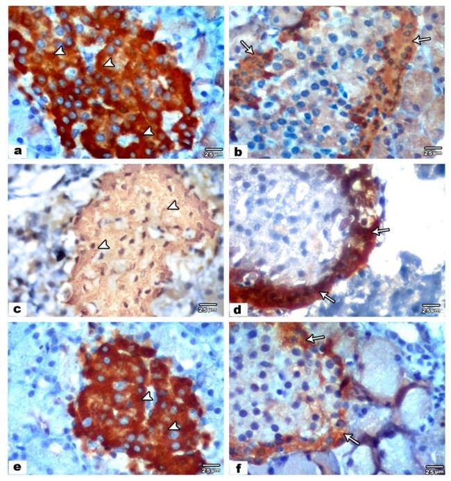 Glucagon Antibody in Immunohistochemistry (IHC)