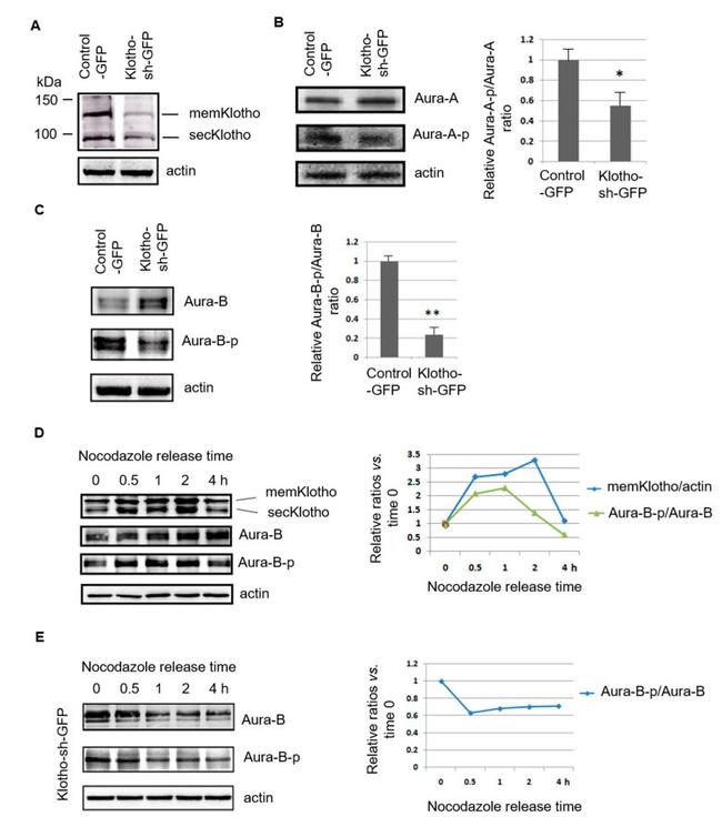 Aurora B Antibody in Western Blot (WB)