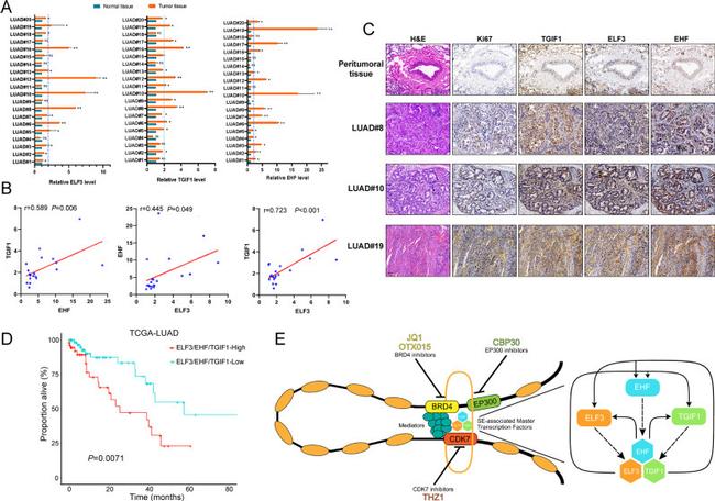 EHF Antibody in Immunohistochemistry (IHC)