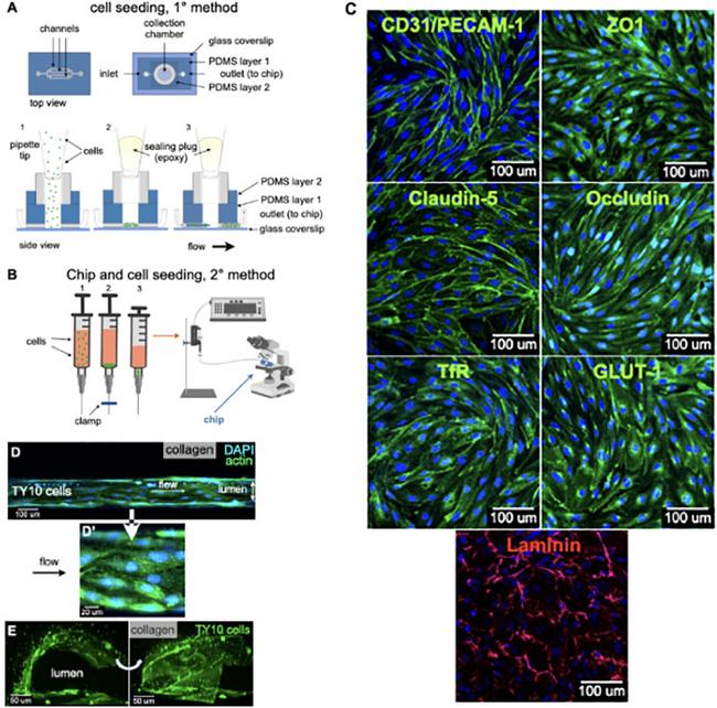 GLUT1 Antibody in Immunocytochemistry (ICC/IF)