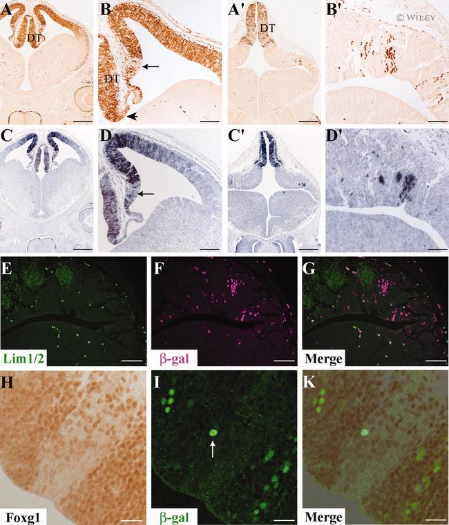 beta Galactosidase Antibody in Immunohistochemistry (IHC)