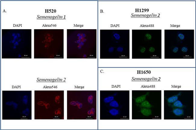 SEMG1 Antibody in Immunocytochemistry (ICC/IF)