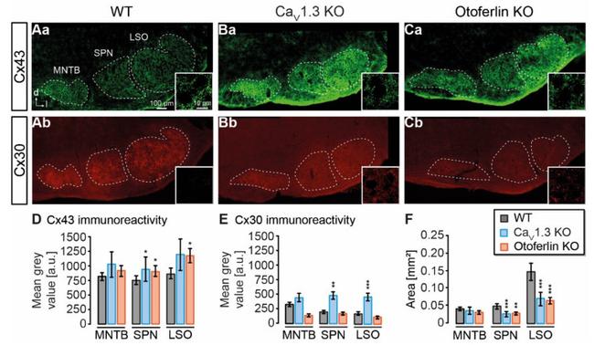 Connexin 30 Antibody in Immunohistochemistry (IHC)